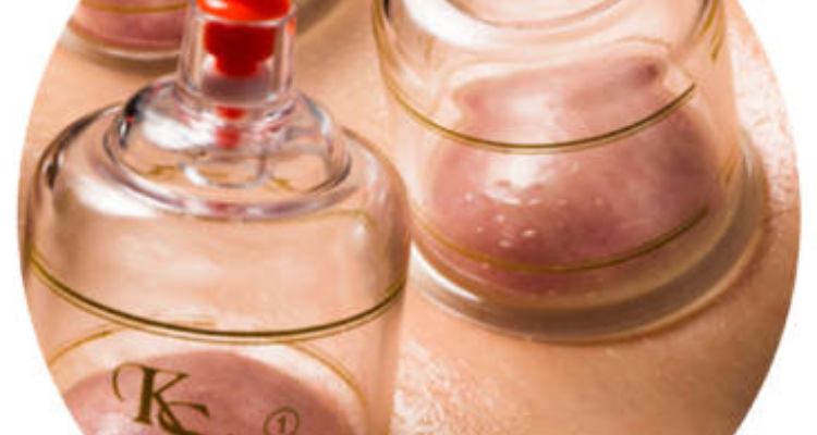 Hijama Clinic (Halina Cupping)