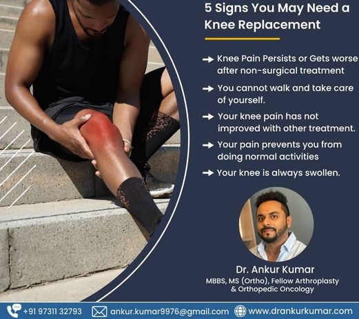 Dr. Ankur Kumar | Best Orthopedic Surgeon