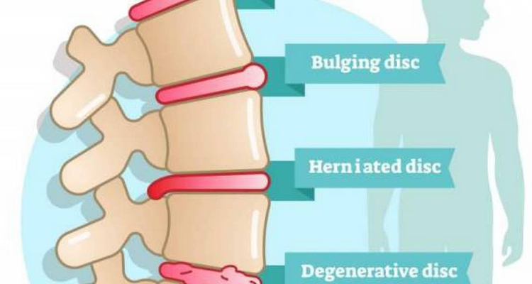 Shree Krishna Physiotherapy and Rehabilitation center (Selakui)