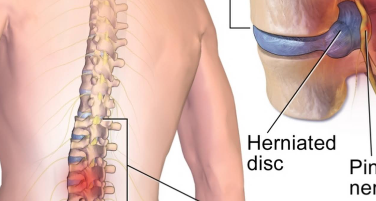 Shree Krishna Physiotherapy and Rehabilitation center (Selakui)