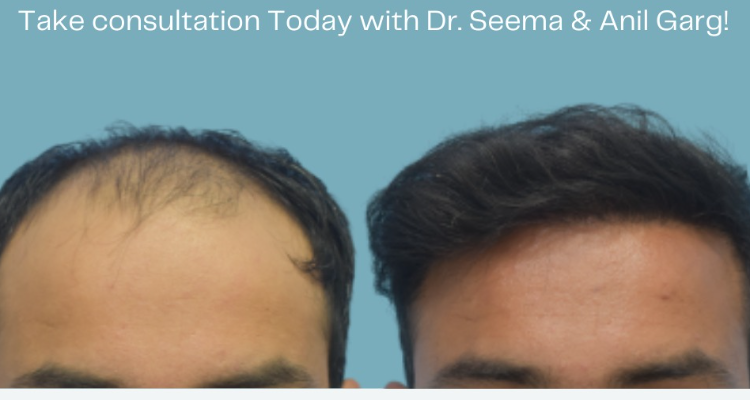 Rejuvenate Hair Transplant | Address Guru