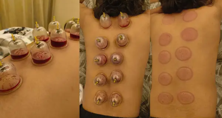 Dr. Deepak Sain - Physiotherapist