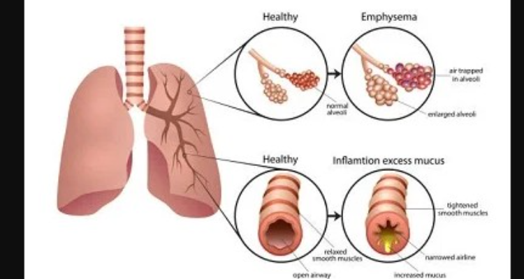 Asthma bhawan