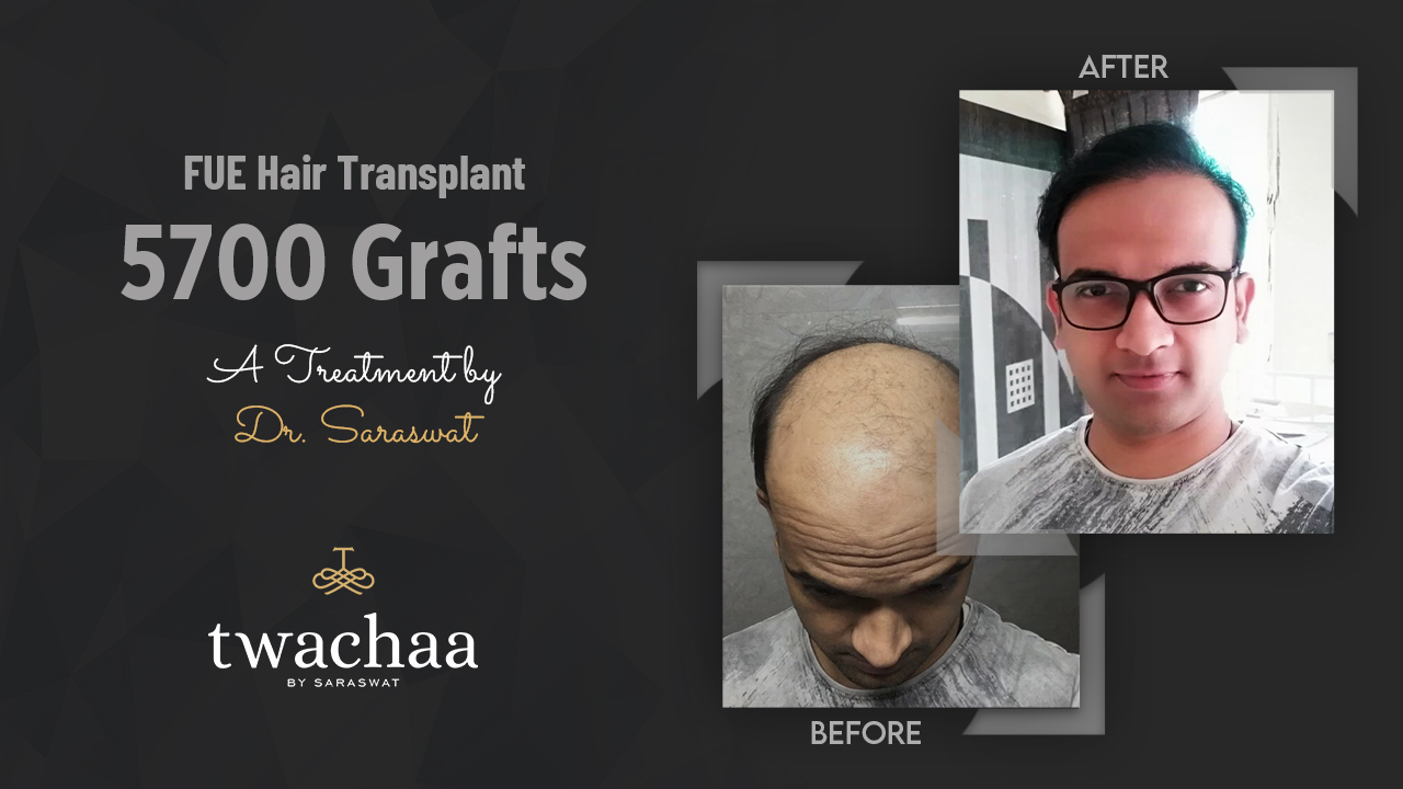 Twachaa By Saraswat™