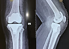 Dr. Kumar Anupam, Best Orthopedic Surgeon in Gaya