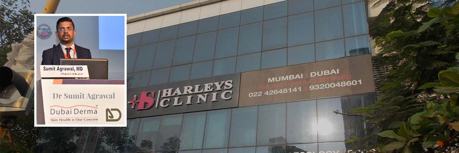 Harleys Hair Transplant in Mumbai